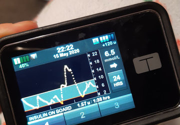 How to access a Dexcom G5 CGM for less